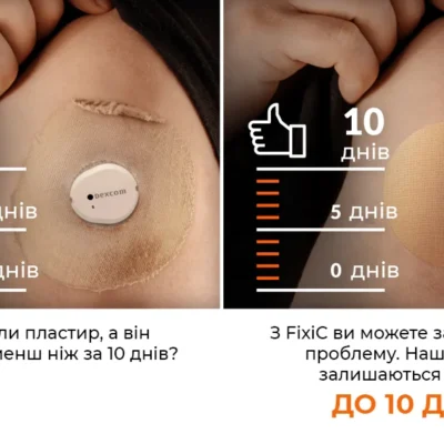 Патч Dexcom G7 на шкірі
